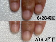 エヌ(N)/ネイリストMami限定