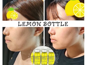 美活ラボ(美活LABO)/【脂肪分解】結果は、半永久的