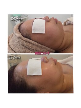 ローズムーン(Rose.Moon)/韓国コルギ2回目