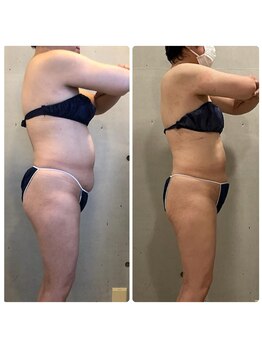 エクセレントビューティーサロン 艶(EN)/サブスクリプション１０ｋｇ減量