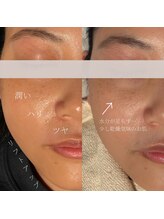 コモレビ(komorebi)/フェイスワックス