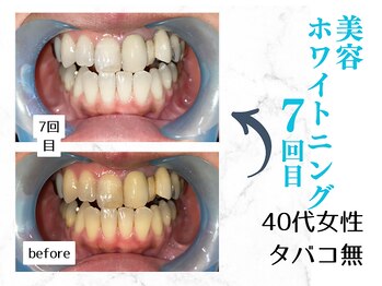 ルカノン(le canon)/写真を撮るのが楽しみです！