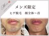【メンズ人気No.1美肌脱毛】ヒゲ脱毛¥4,400☆地域最安値☆