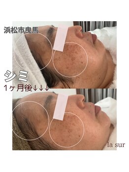 ラシュール(la sur)の写真/【年齢肌に集中アプローチし速攻エイジングケアを◎】ナノ技術×高濃度成分で深いシワ・たるみを徹底ケア♪