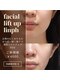 スムース イー(Smooth+E)の写真/【マイクロニードルエイジングケア】ハリツヤ輝く引き締まった肌に♪開き毛穴/シワたるみ改善におすすめ◎