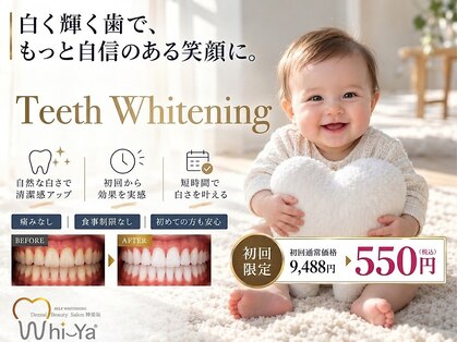 ホワイヤ セルフホワイトニング DBS神楽坂(Whi-Ya)の写真