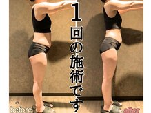 ドクターヴィー 高知(DrVi)/一度で目に見えるスッキリ感を♪