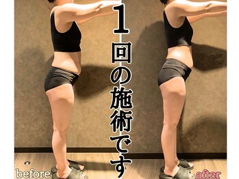 ドクターヴィー 高知(DrVi)/一度で目に見えるスッキリ感を♪