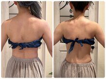 ブリリアント(Brilliant)/結婚式前日に二の腕絞込み