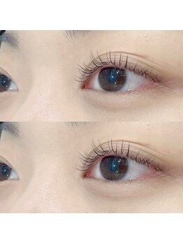 エイルアイ(Aile eye)/ブラック100本