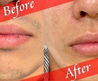 ドシースキンラボ(℃ SKINLAB)