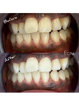 エクリュ(Ecru)/Befor→After