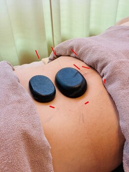 リライフ(Relife)/睡眠の質改善コース