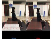 ストレチックス 近江八幡店/慢性的な肩こり、腹部の冷え