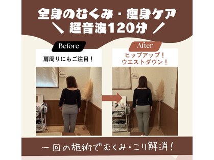 マノン(Manon)の写真