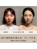天然石カッサヘッド付き|頭蓋骨小顔矯正4回モニターコース ¥32000