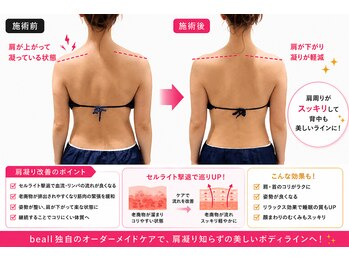 ビオール 新宿店(beall)の写真/【肩こり改善×首長い肩を実現!!】新宿希少WINBACK集中ケア・癒着が強い、慢性首肩こり＆姿勢改善50分￥8800