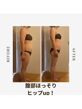 エイミー 藤ヶ丘店(Amy)/before→after