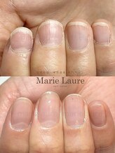 マリーロール 淀屋橋本店(Marie Laure)/自爪育成/深爪矯正/ネイルケア