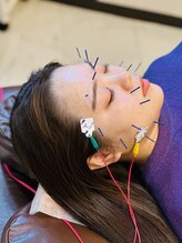 はじめ鍼灸整骨院