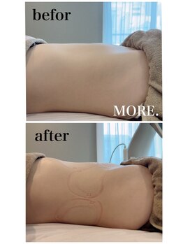 モア 恵比寿(MORE.)/1回のみのbefor&after