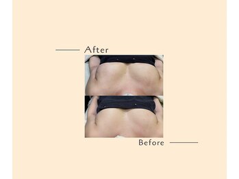 オベリオ(OBERIO)/