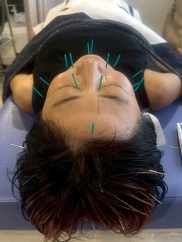 ビーワイ鍼灸整骨院 心斎橋院/施術直後から効果実感