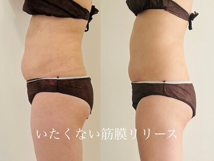 ルナフルール(Luna Fleur)の写真