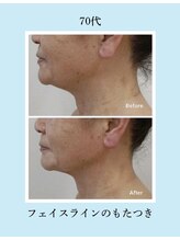 ノト(NOTO)/フェイスライン