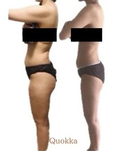 【脱毛・よもぎ蒸しサロン】Quokka/よもぎ蒸し