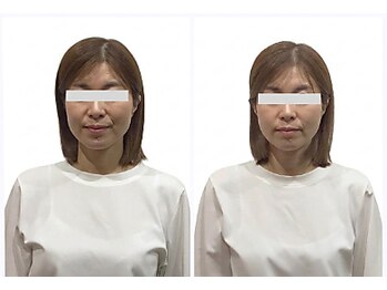 シンメトリー 麻布十番/Before/After