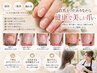 【深爪・二枚爪・割れ爪】爪のお悩み相談＋自爪強化
