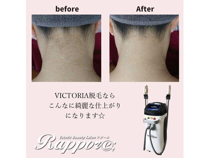 ラポール(rappore;)の写真