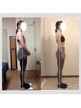 晴れ晴れ整体院/スッキリした立ち姿で綺麗さ倍増