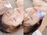 【お顔脂肪/たるみでお悩みの方】ポテンツァ×ハイパーナイフEXフェイシャル