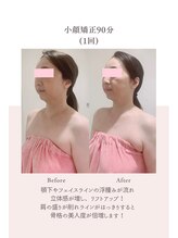 トゥインクル 麻布(twinkle)/麻布十番/広尾/南麻布/小顔矯正