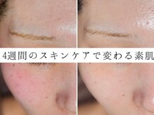 ユウビジン(YOU美人)/