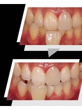 ミラ 中央林間(mira)/小顔　毛穴　ホワイトニング