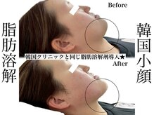 リベルキョウト 京都駅前店(Liber Kyoto)/レモンボトル超え!二重顎撃退