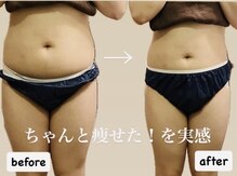 ヨサパーク モア(YOSAPARK MORE)