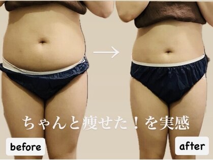 ヨサパーク モア(YOSAPARK MORE)の写真