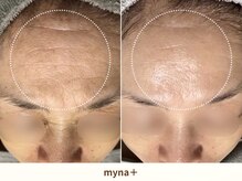 マイナプラ 表参道(myna+)/CHRISTINA/SILK