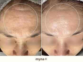 マイナプラ 表参道(myna+)/CHRISTINA/SILK