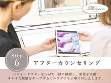 ロココ 神戸三宮店(Rococo)/バスト変化アフター確認