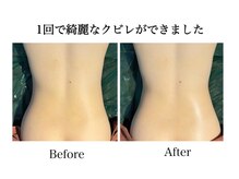 ナチュラーレ 天王寺店(Naturale)/痩身リンパマッサージ二の腕美脚