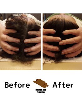 クマの冬眠 高知店/高知ヘッドスパ