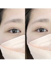 コンジュ ファースト 土橋店(CONJU 1st)/アッパーリフトカールでぱっちり