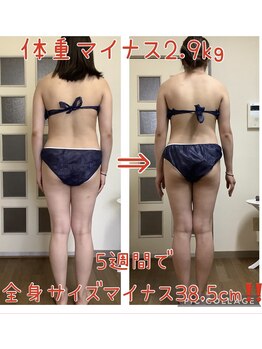 ヨサパーク ヴィヴァン(YOSAPARK Vivant)/短期集中ダイエット！