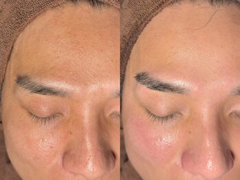 ルーナジェーナ(Luna llena)/池袋　エステ　ルーナジェーナ