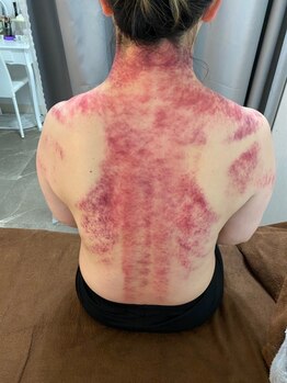 エミール(EMIIR)/